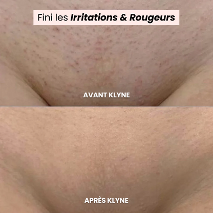 Rasoir Lunyva®