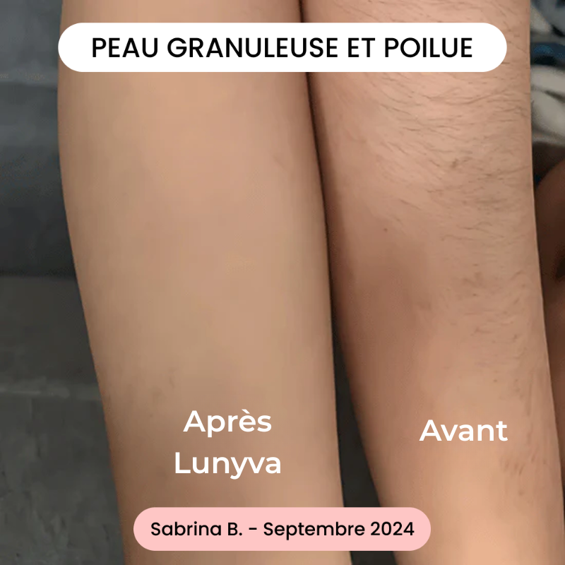 Lunyva - Rasoir Electrique Intime