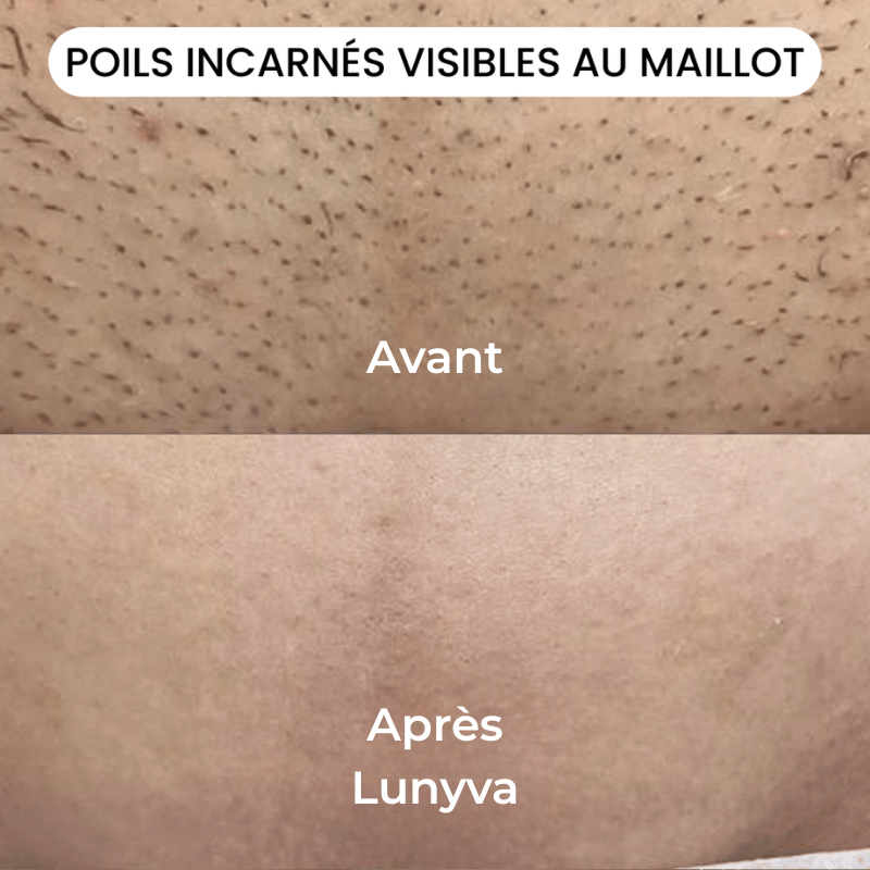 Lunyva - Rasoir Electrique Intime