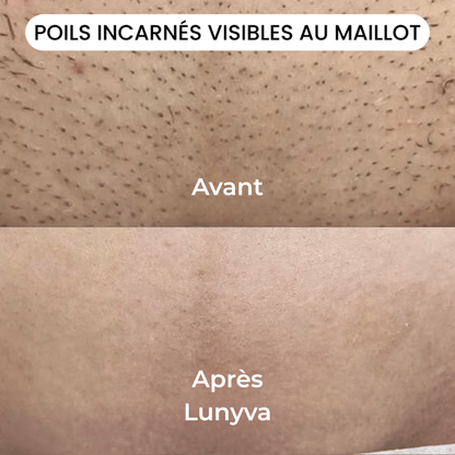 Lunyva - Rasoir Electrique Intime
